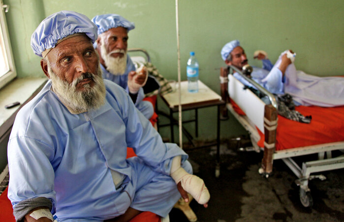 A képen: levágott ujjú férfiak az egyik heráti kórházban (Fotó: Beta/AP)