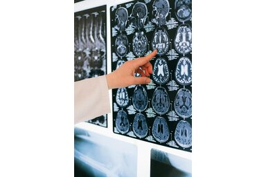 Illusztráció/Pexels