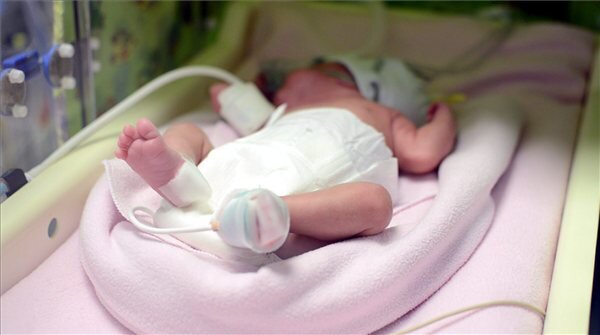 A három hónapig agyhalottként a kórházban kezelt édesanyja méhéből császármetszéssel segítettek világra a babát (MTI Fotó: DEOEC) A három hónapig agyhalottként a kórházban kezelt édesanyja méhéből császármetszéssel segítettek világra a babát (MTI Fotó: DEOEC)